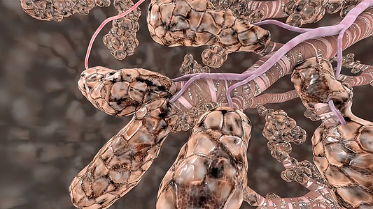 肺循环肺气肿3D医疗图解生活医疗保险援助帮助款待药品技术空气遗传学医生图片