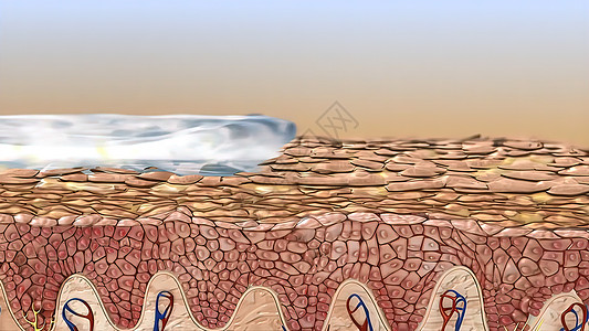 皮层是皮肤的外层 被定义为分层结晶的顶部膜疾病损害皮肤科划痕药品男人干燥症时间湿疹皮疹图片