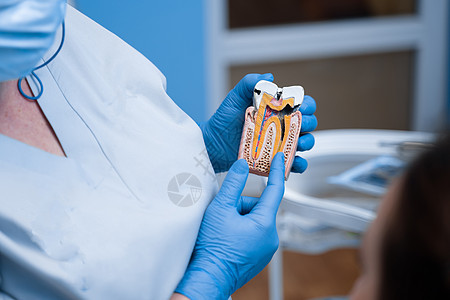 牙科医生展示了牙齿结构 牙的形状 这可真是一副有猫头鹰病态的假牙矫正卫生病人办公室访问口腔科口服诊所运河健康图片