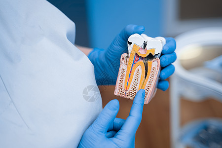 牙科医生展示了牙齿结构 牙的形状 这可真是一副有猫头鹰病态的假牙乐器医院健康访问牙医临床医生钻头橡皮运河图片
