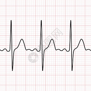 心电图 心电图 心脏工作的图示 健康和医学图片