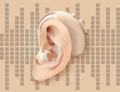 在耳后的数字式助听器 在声波图的背景上 耳鼻喉科听力损失的治疗和修复 现实的矢量图 医药卫生工具插图衬垫器官药品模拟投票塑料身体图片