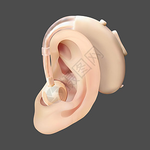 在耳朵后面的助听器 在声波图的背景上 耳鼻喉科听力损失的治疗和修复 现实的矢量图 医药卫生图片