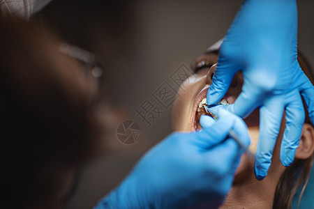 美容需要被困扰牙医牙科金属女士药品诊所手套牙齿病人保健图片