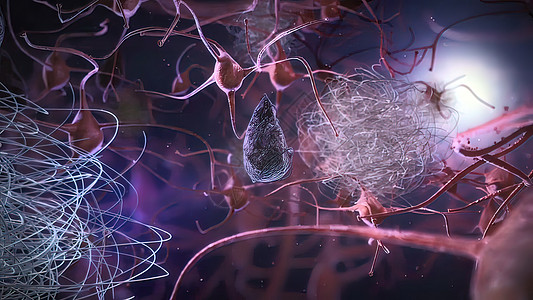 神经神经元阿尔茨海默氏病数据损失网络颅骨纤维中风健康科学疾病神经系统抗体科学生物图片