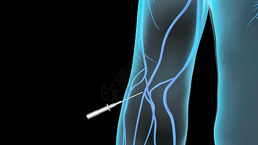 从腿到身体的血液中流出毒血外科手术器官腹部女孩插图药品消化细胞科学图片