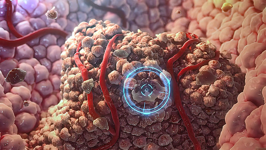 3D 说明 免疫细胞摧毁癌症细胞医疗分子生理结构文件预防宏观医学胰腺癌细胞图片
