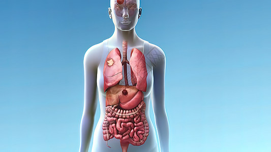 肺癌从肺部开始 扩散到其他地区 在肺部疾病肠胃膀胱身体药品痛苦器官解剖学渲染肠溶图片