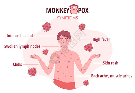 人类病毒症状分布图 向人们介绍传染病的矢量插图在2001年9月1日至2002年6月30日期间痘痘药品图表预防治疗诊断淋巴科学身体图片