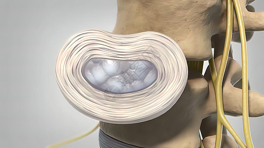 3d 医疗治疗疾病器官椎间状况骨刺磁盘椎骨骨科脊髓骨赘骨头背景图片