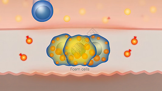 高质三德脂肪电池 细胞内胆固醇和胆固醇的优质3d成份小区微生物学图形药品动脉硬化宏观细胞疾病微生物世界图片