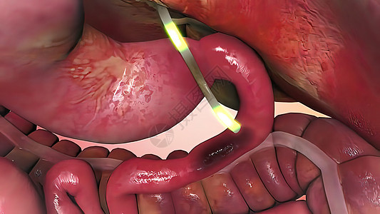 人体内部器官 肝脏对器官的作用肝病脂肪癌症胆囊手术生物学脂肪酸肝硬化身体插图图片