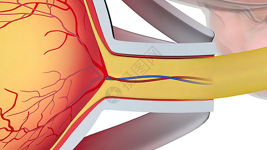 Glaucoma是一种眼睛状况 它损害光神经 对良好的视力至关重要教育巩膜药品青光眼乐器静脉结膜眼镜3d瞳孔图片