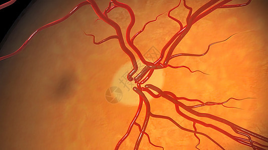 Glaucoma是一种眼睛状况 它损害光神经 对良好的视力至关重要肌肉科学保健手表角膜脉络膜教育药品静脉视网膜图片