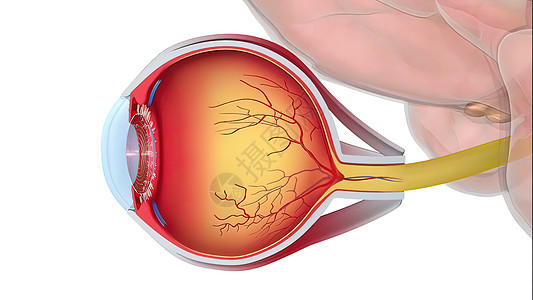 Glaucoma是一种眼睛状况 它损害光神经 对良好的视力至关重要解剖学镜片鸢尾花眼科静脉青光眼结膜玻璃科学巩膜图片