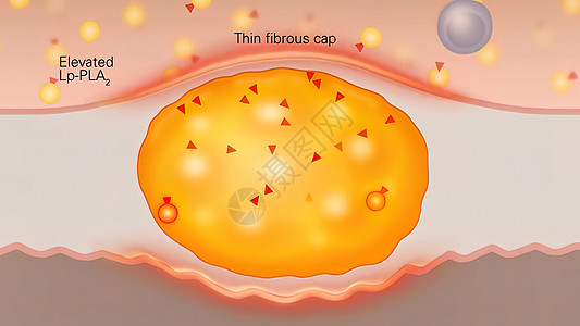 高质三德脂肪电池 细胞内胆固醇和胆固醇的优质3d成份动脉硬化微生物宏观图形细胞动脉粥样硬化脂肪细胞膜科学美丽图片