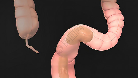 人类消化系统解剖毒素同化便秘食管排毒肠道科学胃肠道过程药品图片