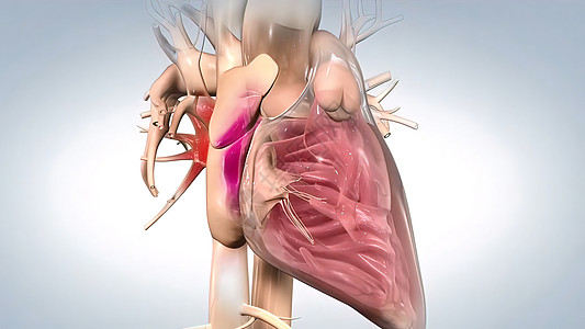 症状导致血液弹射到动脉和肺后备箱中心脏病胸痛心脏疾病速度病人心绞痛攻击疼痛胸部图片