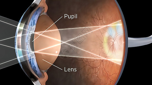 人眼视觉结构手术神经科学眼球脉络膜肌肉外科图表瞳孔视网膜图片