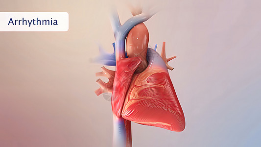 心力衰竭意味着心脏无法正常地将血液泵送到全身各处心律失常脉冲惊恐心脏病衣服痛苦压力心律心室成人图片