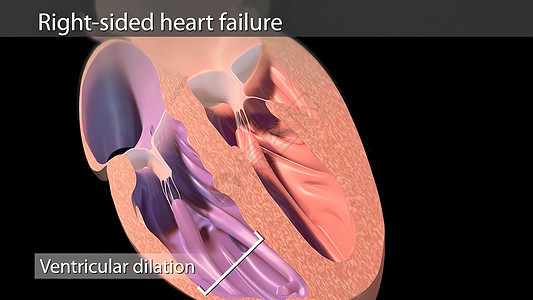右心室从静脉中提取血液 抽到右心室医疗人心心肌药品绘图医学系统保健木耳主动脉图片