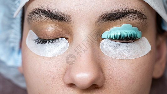 白种女人接受眼花切除手术 前后都这样优雅体积沙龙化妆品魅力指甲花染料女孩眼睛女性图片