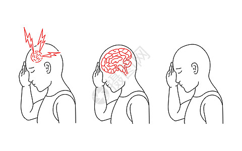 用矢量来说明一个人头痛和脑炎症发作的病历 20神经红色图表疾病压力男性插图男生卫生男人图片