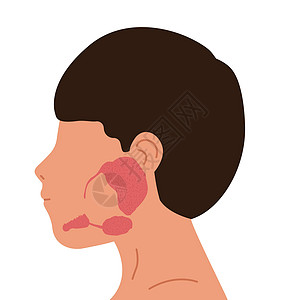 人体和血清腺 干草地 亚生物圈和亚语言的腺 医学病媒说明图片