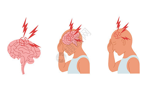用矢量来说明一个人头痛和脑炎症发作的病历 20插图男性压力心理学炎症症状脑炎男人信息卫生图片