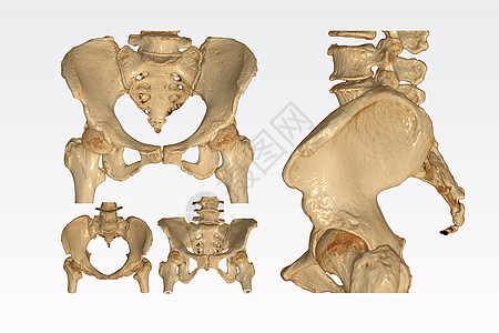 收集CT扫描骨盆骨骼 两根臀关节3D将图像隔离在白色背景上 切换路径图片