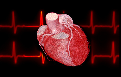 CTA 冠动脉3D在屏幕上显示图像 以诊断船只冠动脉衰竭主动脉疾病心脏动脉射线插图ct适应症断层临床图片