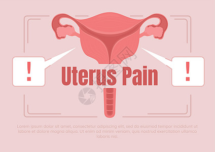 Uterus 止痛平坦矢量横幅模板图片