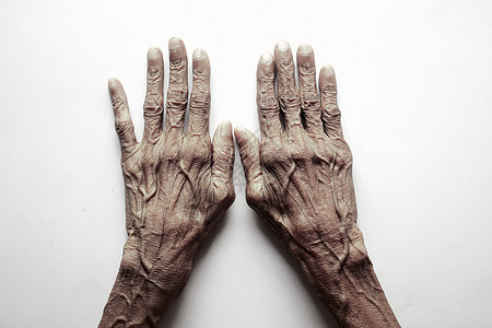 以老年人的手紧贴近老人的手解剖学黑色皮肤疼痛白色老年手指症状拇指展示图片
