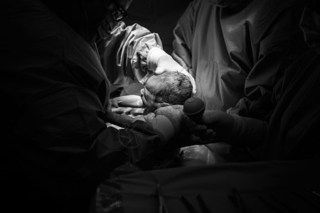 剖腹产手术正在进行中婴儿外科医院劳动妈妈切口妇科送货手套新生图片