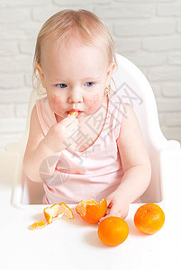 长着食物过敏的可爱小孩幼儿白色保健孩子红色划痕卫生症状皮炎皮肤科湿疹图片