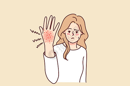 不幸的妇女因手头上的皮疹而痛苦不堪图片