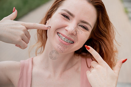 长着牙套的红发年轻女人 在夏天露出户外微笑嘴唇矫正牙医成人牙齿女孩学生治疗幸福药品图片