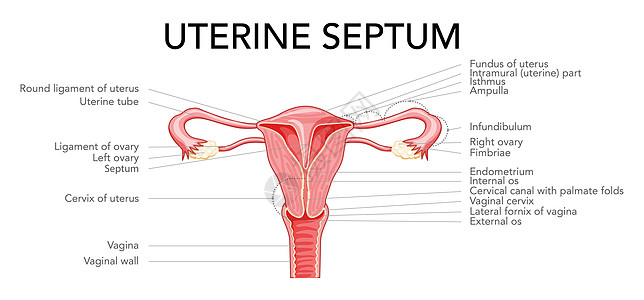 子宫隔膜隔膜子宫女性生殖系统图与铭文文本 切割中的前视图 人类图片