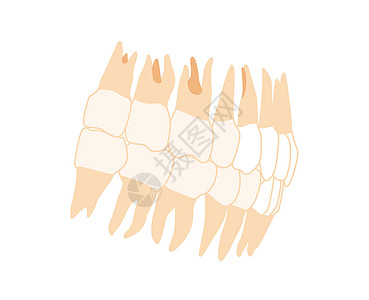 人类牙齿假牙设置连接人类侧面的横向视图 人下巴模型与牙排相配 一组混凝土现成平板图片