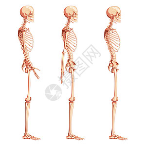 人类肩部侧观 无臂 张开和后背手臂姿势 一套现实的医用平板自然颜色图片