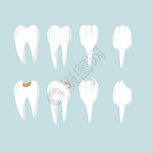 一组扁平的牙齿 健康的牙齿和腐烂的牙齿 牙科和牙齿健康 矢量图图片