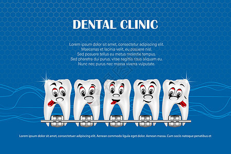 3d 矢量图 逼真的牙齿 上下颌有牙套 对齐牙齿的咬合 牙列与牙套 牙套工具药品卫生微笑支撑牙疼牙医医生健康矫正图片