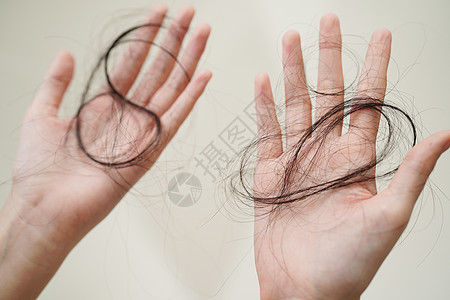 亚裔妇女手上的长发夹带有问题梳子损失刷子脱发女士保健压力卫生女性损害图片