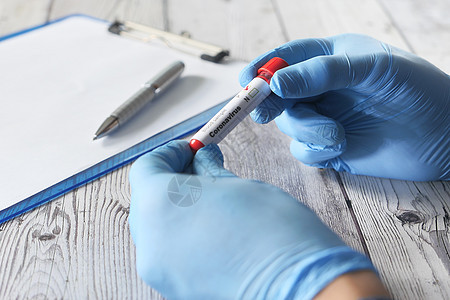 手持血液测试管并用纸写作的化验室技工背景图片