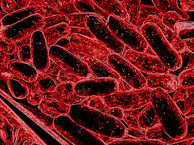 特写 3d 微观细菌 3D 渲染细菌特写 病毒或细菌细胞高分辨率科学插图痘痘实验计算机微生物学感染流动猴痘生物癌症显微镜图片