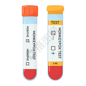 脑天花病毒测试的血液样本管 阳性或负性测试 测试系统图片