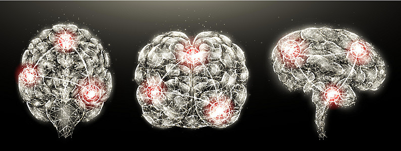 深色背景下人脑炎症性疾病的多边形图解 大脑发炎 低聚设计 神经系统疾病医学横幅 模板或背景图片