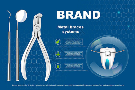 3d 矢量图 带牙套的逼真牙齿 对齐牙齿的咬合 牙列与牙套 牙套矫正正畸护理卫生凹痕药品曲线诊所治疗工具图片