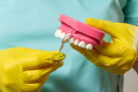 有牙签的牙医 和人下巴的布局药品嘲笑卫生空腔治疗教育假牙牙齿假肢示范图片