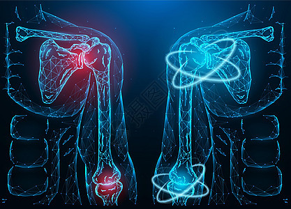患病发炎的人肩肘关节的多边形矢量图和肩肘功能的恢复 医疗横幅 模板或背景背景图片